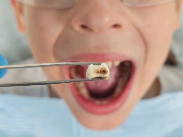 Best Emergency Pediatric Dental Care in Ninnekah, OK