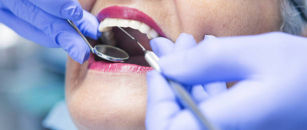 Best Broken or Chipped Tooth Repair in Ninnekah, OK